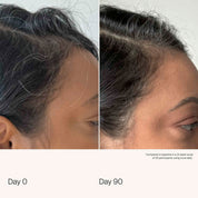 Side-by-side close-ups of a person’s hairline and temple labeled Day 0 and Day 90 show less grey hair and fuller coverage after consistent use of Scalp Care Density Serum.